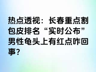 热点透视：长春重点割包皮排名“实时公布”男性龟头上有红点咋回事？