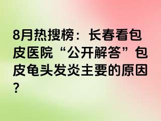 8月热搜榜：长春看包皮医院“公开解答”包皮龟头发炎主要的原因？