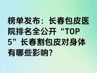 榜单发布：长春包皮医院排名全公开“TOP5”长春割包皮对身体有哪些影响？