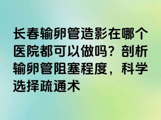 长春输卵管造影在哪个医院都可以做吗？剖析输卵管阻塞程度，科学选择疏通术